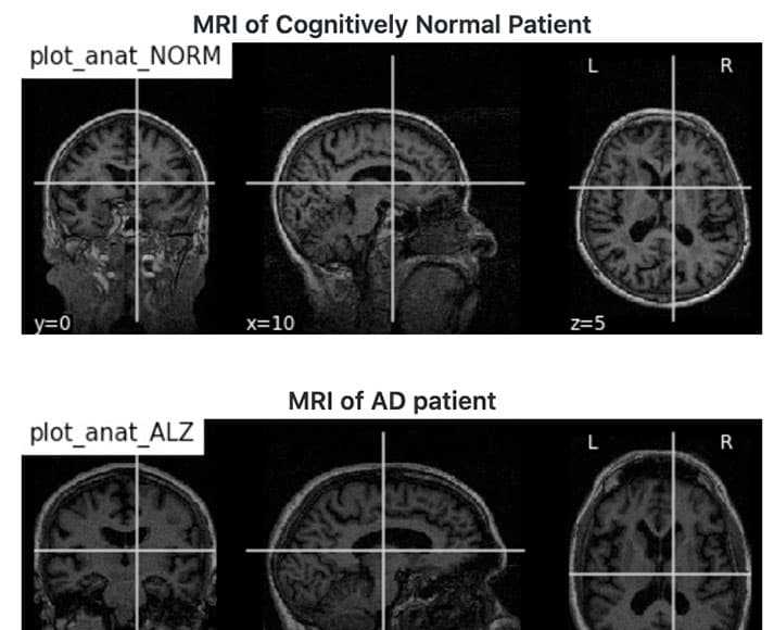 project-glynnis-mattheisen