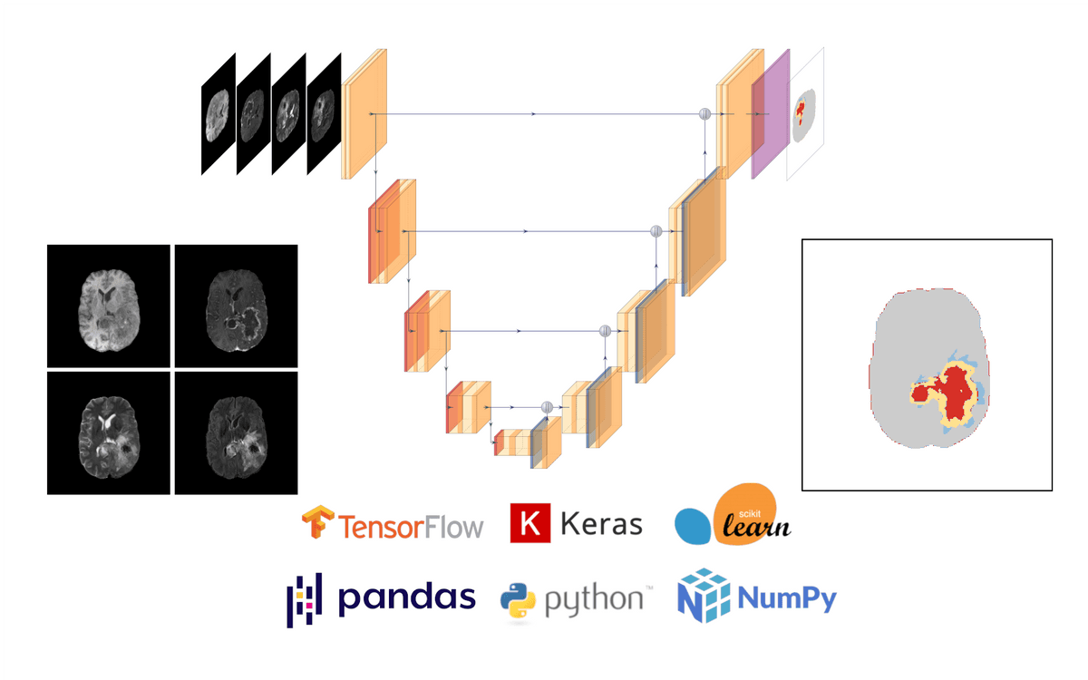 Graphic representation of a neural network for medical image processing with software logos.