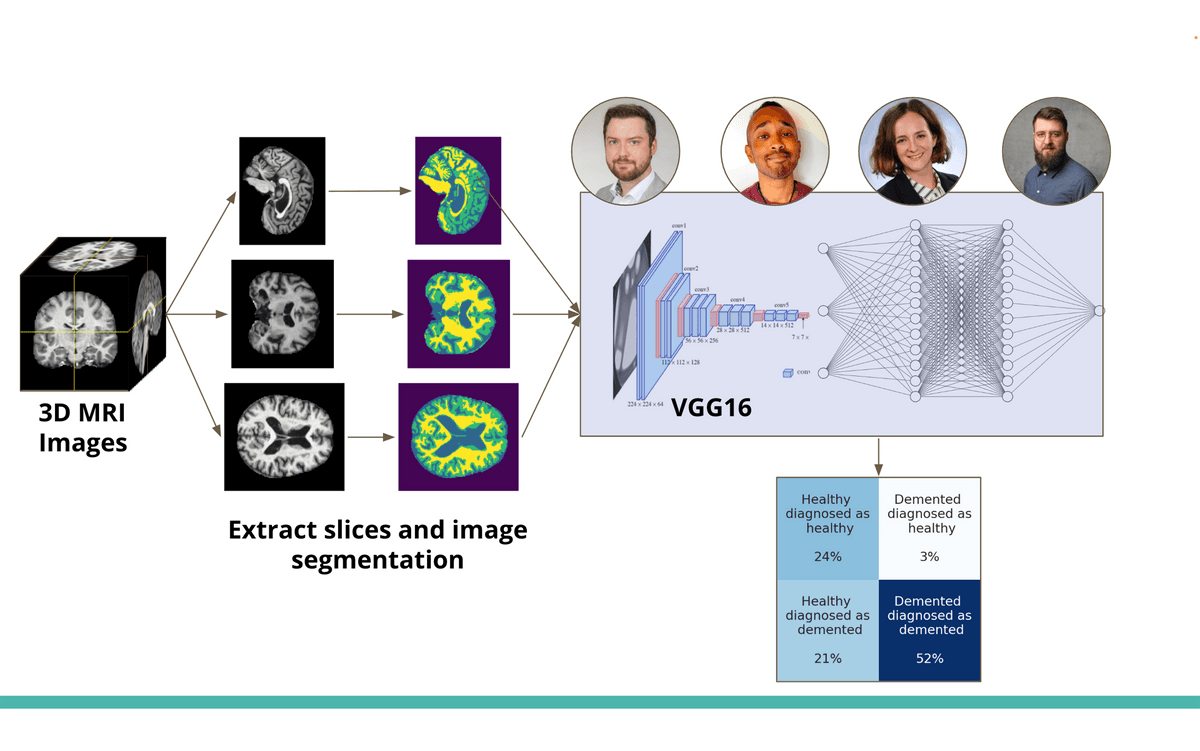 Visualization of 3D MRI image processing and classification using the VGG16 model.