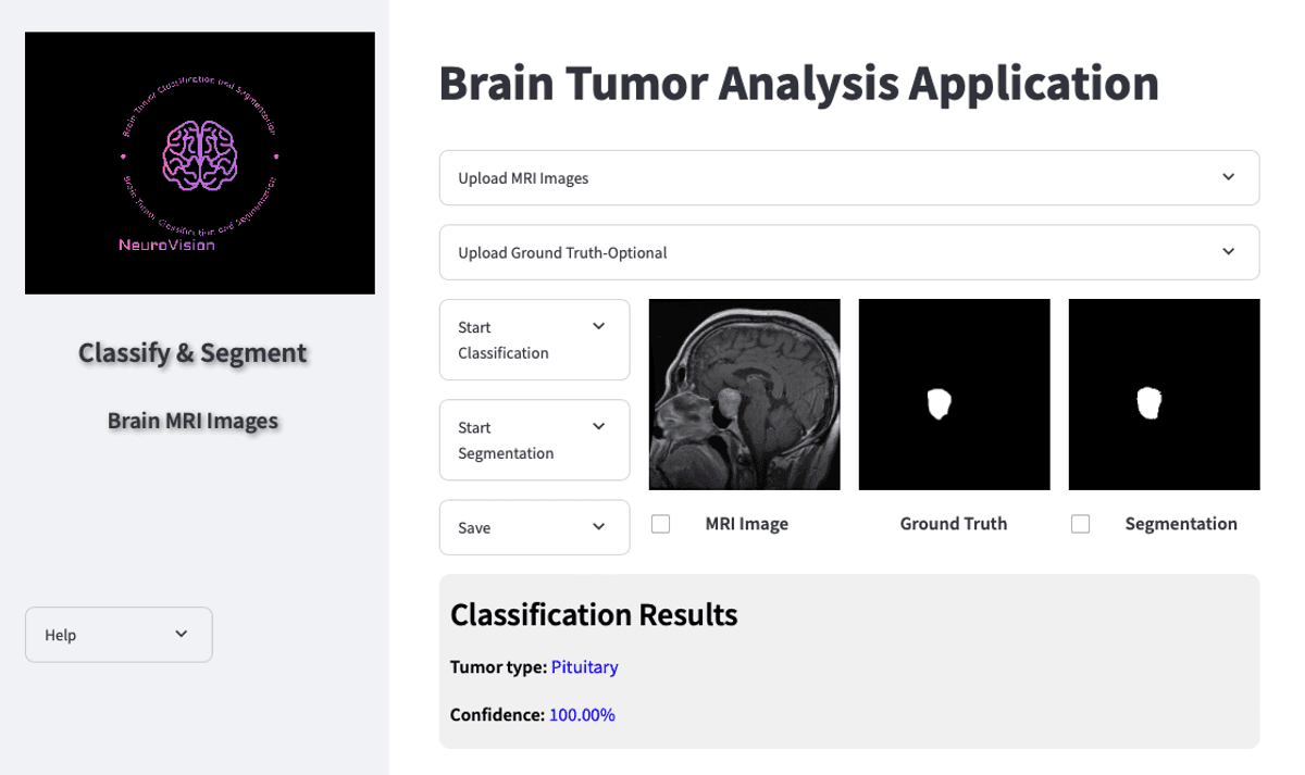 NeuroVision - A tool for brain tumor classification and segmentation