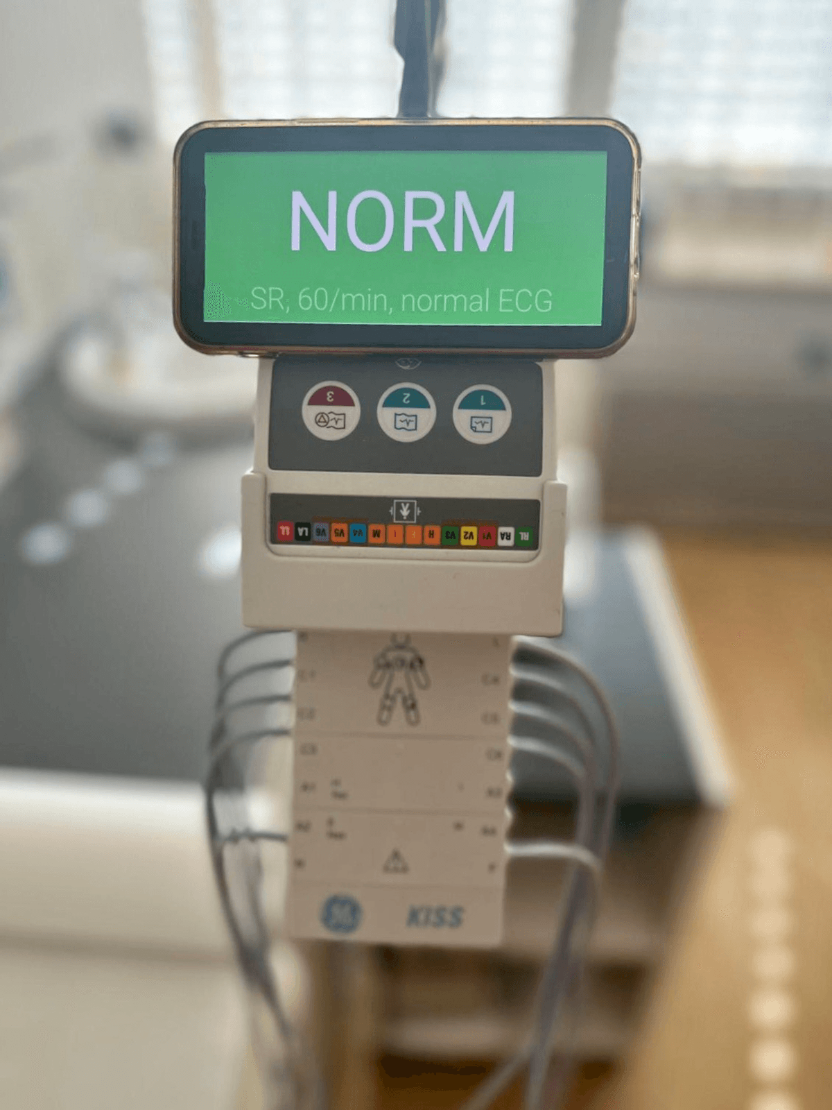 Automated ECG classification and feature visualization